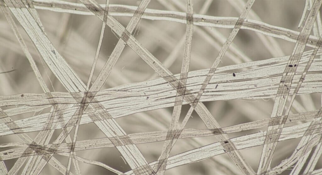 Microscopic view of interwoven fibers